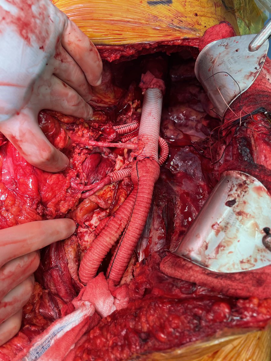 Nick Osborne tweet media