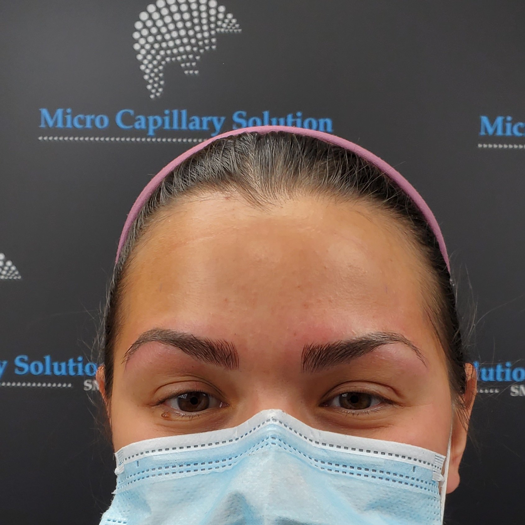 Micro Capillary Solution (microcapillary) / Twitter