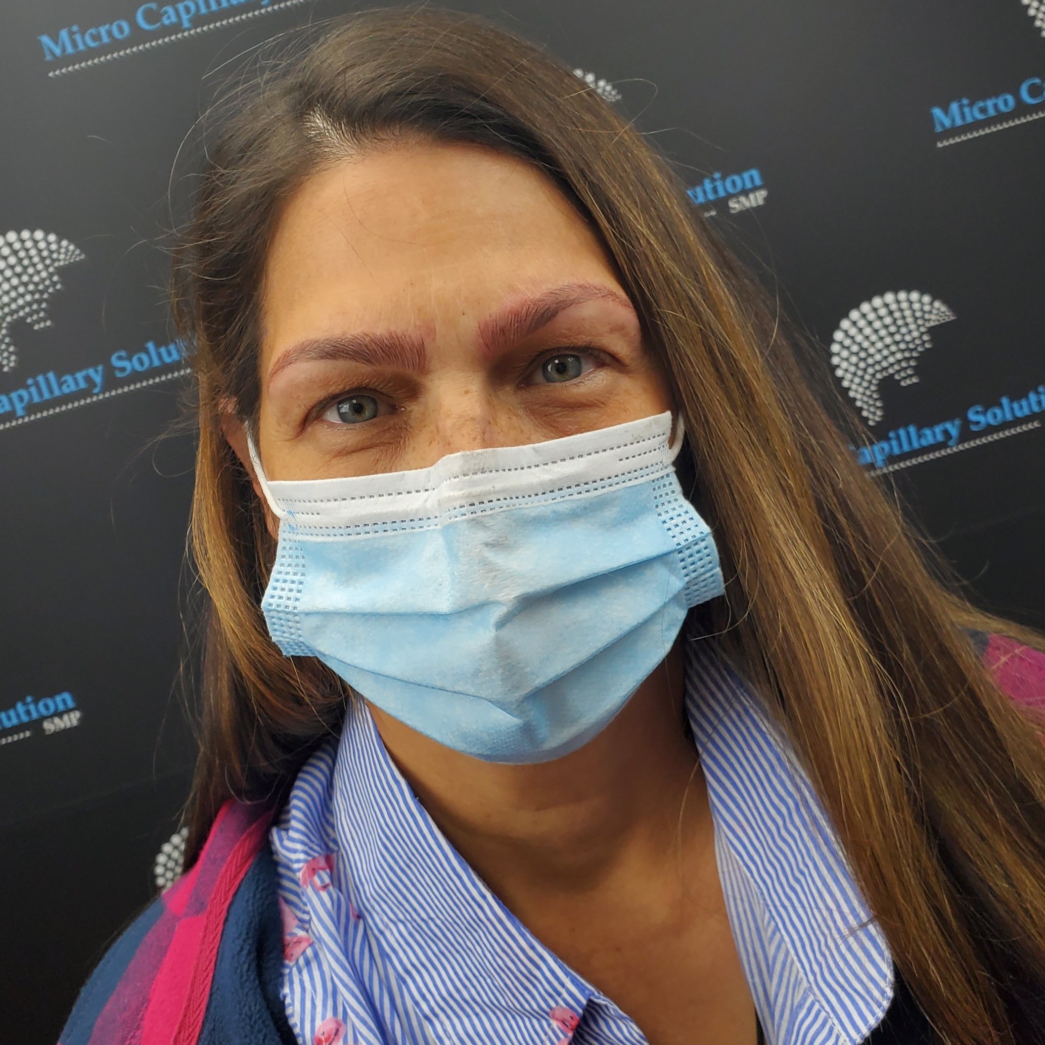 Micro Capillary Solution (microcapillary) / Twitter