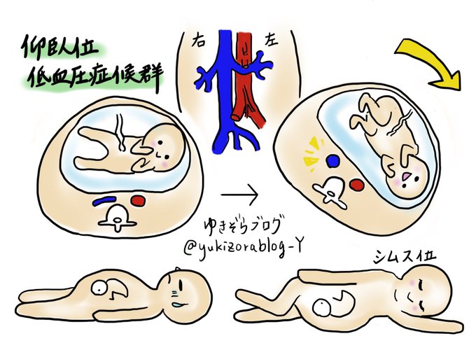 低血圧のtwitterイラスト検索結果