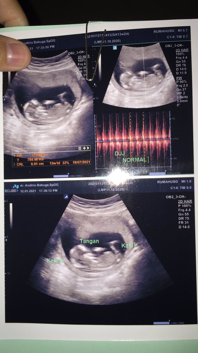 sarrmil's tweet image. Haloo dek sehat sehat ya di dalem sampe nanti kita jumpa dan ngopi bareng 🖤 #19w