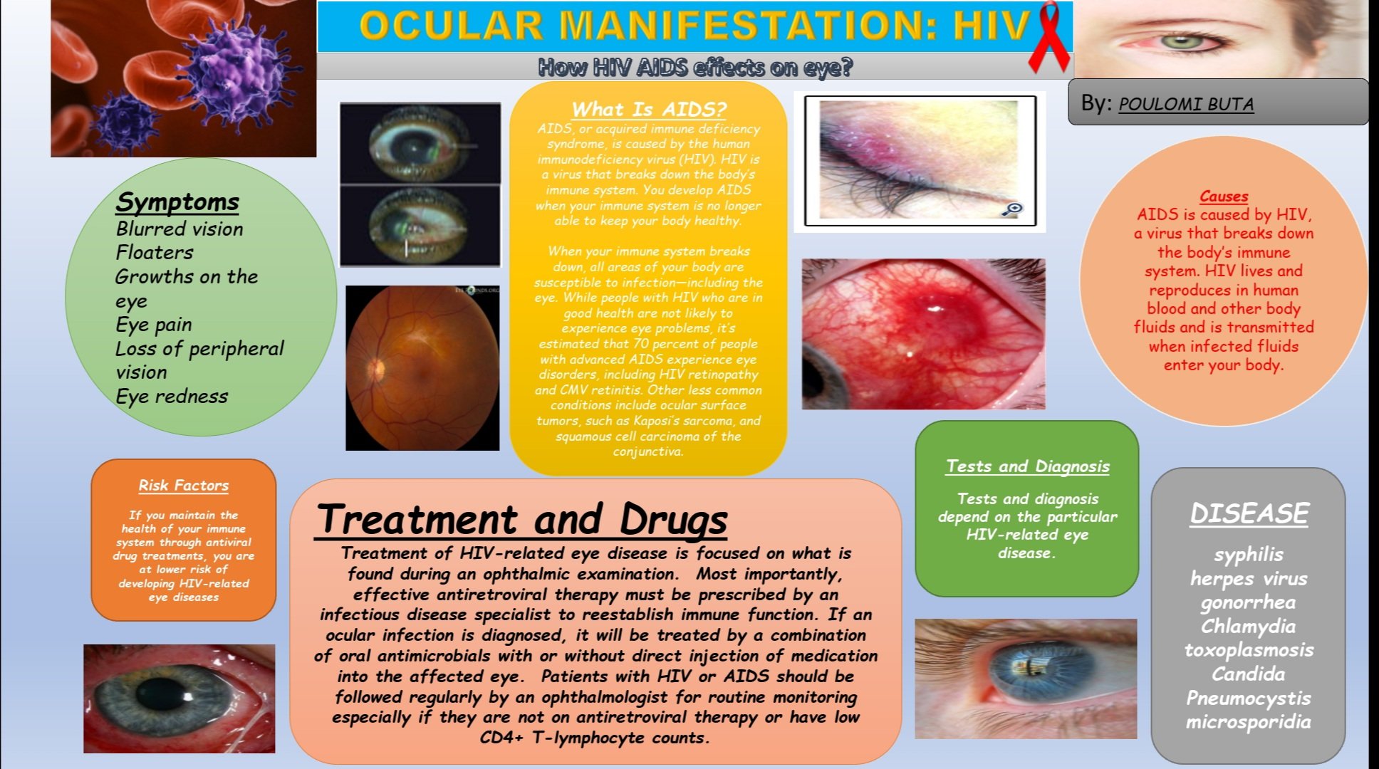 Hiv Retinopathy Symptoms