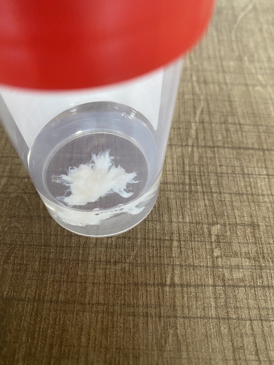 Een turbulent weekend achter de #rug met de schuldige op sterk water. Nu even aan de “andere kant” van de #hulpverlening met toch wat angst en twijfels. Rug rechten en moedig vooruit kijken!