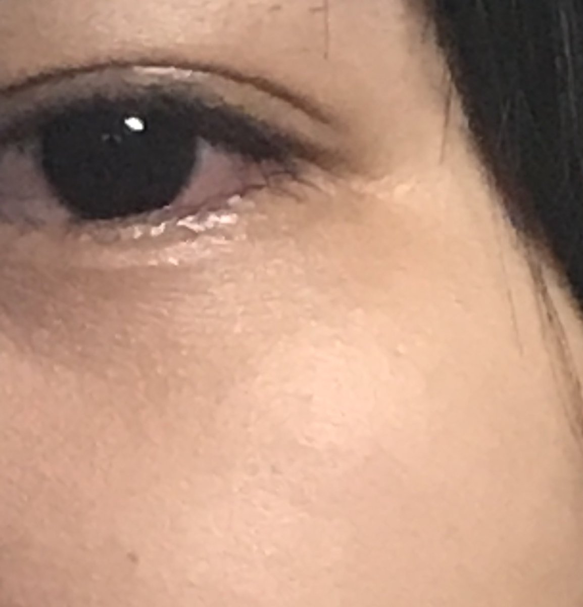 eyeyeyeeet's tweet photo. รูปภาพนี้ตรงใต้ตาของเรามีลอยเล็บอยู่ ซึ่งเล็บนั้นเป็นเล็บของคนที่เรารักมาก 
เพราะมันคือเล็บของแม่ไงล่ะ ที่มาตบหน้าในวันนี้ เราว่ามันไม่สมควรเลยที่เขาโมโหแล้วมาตบเรา แต่พอเราโมโหบ้างทำได้แค่ทำร้ายร่างกายตัวเอง #พ่อแม่รังแกฉัน #โรคซึมเศร้า #ครอบครัวไม่ใช่เซฟโซน https://t.co/IjptmSA6jP