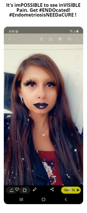 DeViouSDoLL82's tweet photo. #Endometriosis #InterstitialCystitis #EndometriosisAwareness #InvisiblePain #EndoPainWarrior #InvisibleIllness #1in10 #ChronicPainProblems #EndEndo  #MarchIsEndometriosisAwarenessMonth #EndometriosisNEEDaCURE https://t.co/w4PYMR7dl3