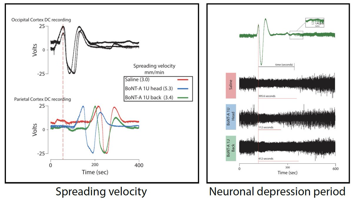 Extracranial injections of #onabotulinumtoxinA shorten cortical depression period without affecting induction, occurrence, or propagation of #CSD. Peripherally applied onabotulinumtoxinA alters a neuronal function in #CNS
#botox #migraine <a href="/PAINthejournal/">PAIN Journal</a> 
bit.ly/37xotWT
