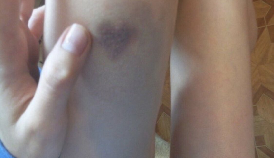 r0ttingbones's tweet photo. thinspo i’m obsessed w thread https://t.co/rfVSbT3OQw