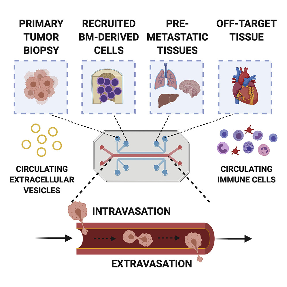 Gordana Vunjak-Novakovic (@gvnlab) on Twitter photo So excited to announce our new review, written by <a href="/PamGraney/">Pam Graney, PhD</a> <a href="/naveedtavakol/">Naveed Tavakol, PhD</a> <a href="/ChramiecAlan/">Alan Chramiec</a> <a href="/KaceyRonaldson/">Kacey Ronaldson-Bouchard</a>, is out in <a href="/CellPressNews/">Cell Press</a> <a href="/iScience_CP/">iScience journal</a> & describes progress in modeling tumor metastasis with regards to immune cell contributions! Check it out: sciencedirect.com/science/articl… So excited to announce our new review, written by <a href="/PamGraney/">Pam Graney, PhD</a> <a href="/naveedtavakol/">Naveed Tavakol, PhD</a> <a href="/ChramiecAlan/">Alan Chramiec</a> <a href="/KaceyRonaldson/">Kacey Ronaldson-Bouchard</a>, is out in <a href="/CellPressNews/">Cell Press</a> <a href="/iScience_CP/">iScience journal</a> & describes progress in modeling tumor metastasis with regards to immune cell contributions! Check it out: sciencedirect.com/science/articl…