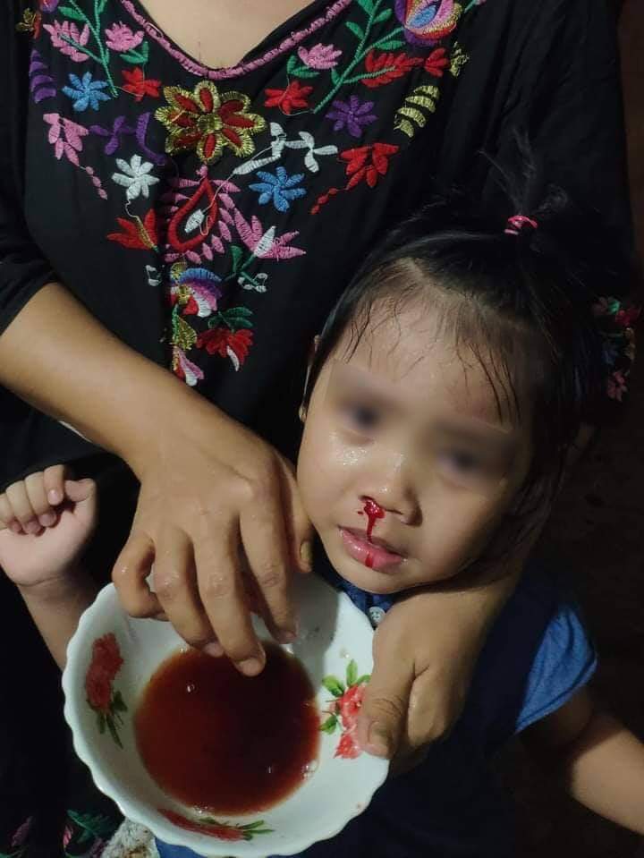 Saimauckkham's tweet photo. This little girl is suffering from tear gas and she said she cant breath well. Happening now in SanChaung, Yangon.
Military terrorize people in suburbs after 10pm.
@YourAnonCentral @UN @SpartaZC

TW//blood
#Mar8Coup
#WhatsHappeningInMyanmar
#SaveMyanmar
#MyanmarMilitaryTerrorists https://t.co/6JZUTBIxdB