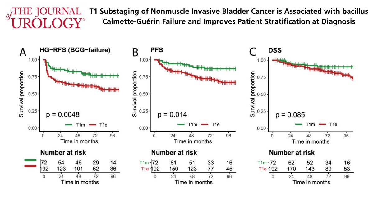 Journal of Urology (@jurology) on Twitter photo Open Access Article from the March 2021 Issue:
T1 Substaging of Nonmuscle Invasive #BladderCancer is Associated with bacillus Calmette-Guérin Failure and Improves Patient Stratification at Diagnosis
Read the full text here: bit.ly/32OZzzS
<a href="/FCdeJong/">Christiaan de Jong</a> Open Access Article from the March 2021 Issue:
T1 Substaging of Nonmuscle Invasive #BladderCancer is Associated with bacillus Calmette-Guérin Failure and Improves Patient Stratification at Diagnosis
Read the full text here: bit.ly/32OZzzS
<a href="/FCdeJong/">Christiaan de Jong</a>