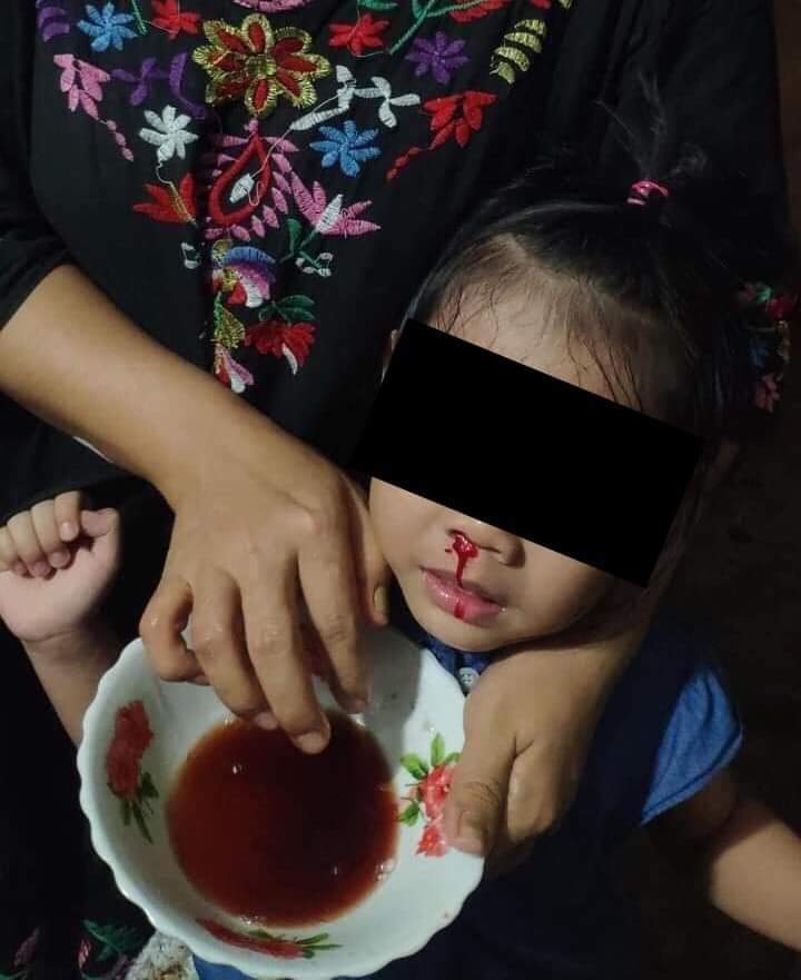 tw// Blood//Injury
A young child from Baho road, Sanchaung from Yangon is suffering from tear gases which was used by Myanmar Military tonight.

STOP SIEGE 

#WhatsHappeningInMyanmar
#Mar8Coup