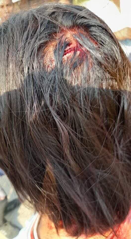 ShangSh71859478's tweet photo. tw // wound

This morning, terrorists force deployed in many universities and hospitals. Some teachers are violently beaten in MTU(MIT) university. 

Source: VOM

#WhatsHappeningInMyanmar  #Mar7Coup https://t.co/iXCedFs9zx