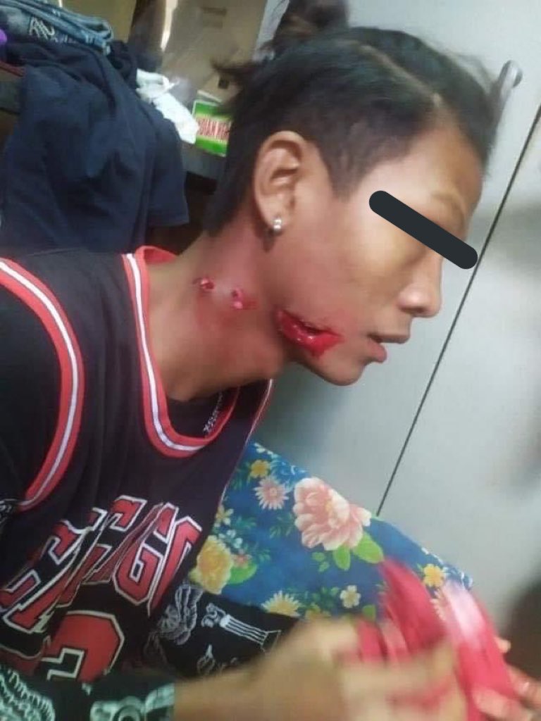 hannayuri_twt's tweet photo. TW// Blood Gunshot

In Bagan, even famous ancient and a UNESCO World Heritage of Myanmar. Terrorists opened gunfire and violet brutally .They shot around 5times and a civilian injured.

#WhatsHappeningInMyanmar 
#Mar7Coup https://t.co/8jcwqtQLdm
