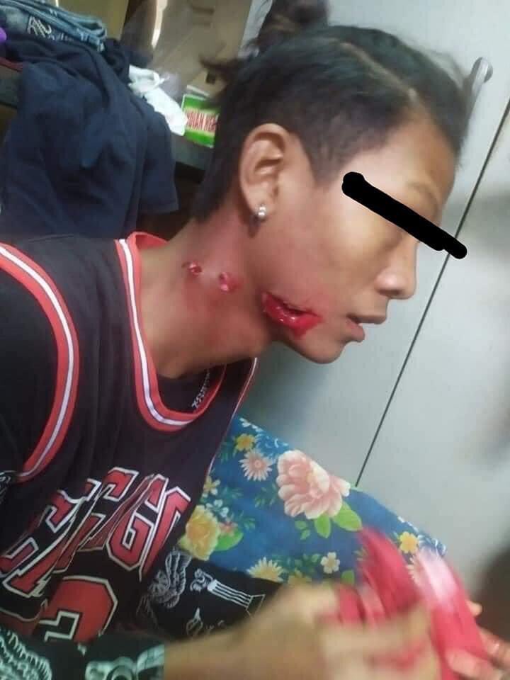 ChaeYou56071446's tweet photo. @YourAnonCentral Tw // blood 
Although Bagan is an ancient city and a UNESCO World Heritage Site, terrorists raided and shot unarmed peaceful protesters with real bullets.
R2P FOR MYANMAR
@RapporteurUn @UNHumanRights
@UNESCOEU @freya_cole
@BBCWorld @Voaburmese

#WhatsHappeningInMyanmar
#Mar7Coup https://t.co/yJdFHZByWb