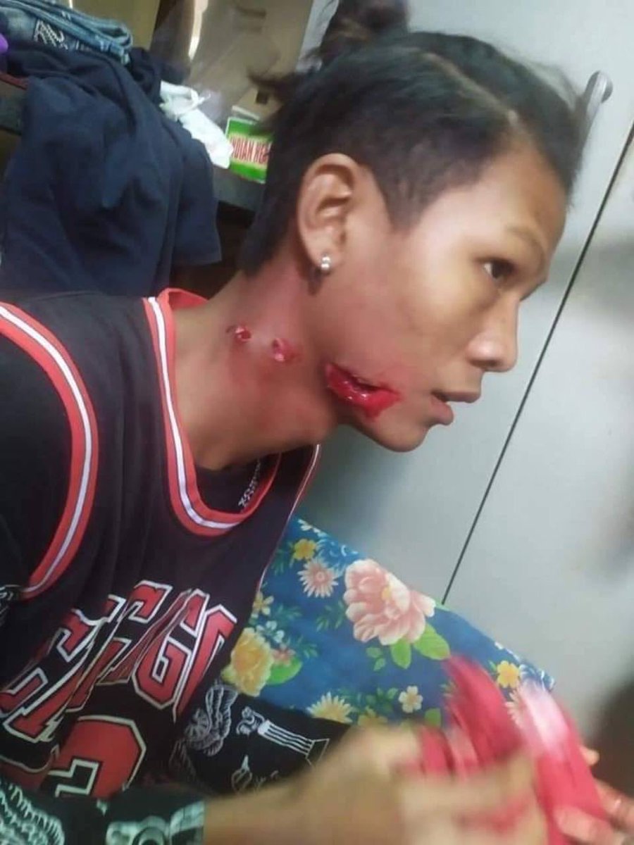 kurisutarukiru's tweet image. Bagan 
ပုဂံမှာ ဒီနေ့ မနက် ၁၀ နာရီလောက်က ပစ်ခတ် လူစုခွဲပါတယ်။ လူငယ်တဦး ကျည်ဆံရှပ်မှန်ပါတယ်။ #AgainstMyanmarMilitaryCoup #March7Coup #Bagan #WhatsHappeningInMyanmar