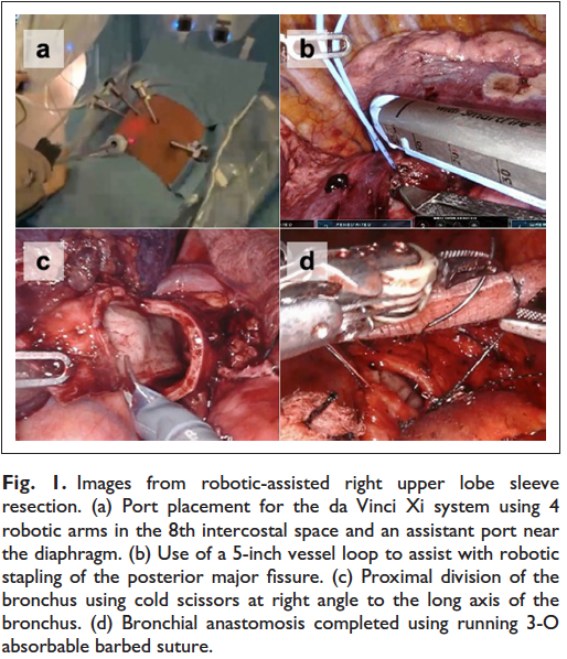 Elliot Servais, MD, FACS tweet media