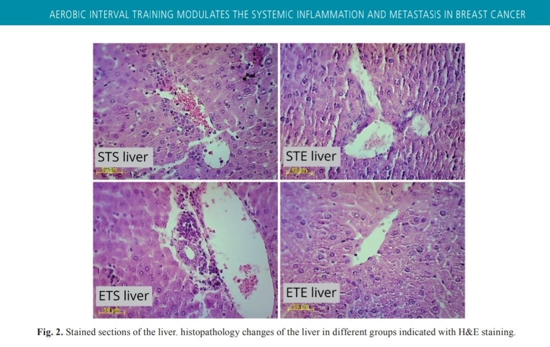 fari_tj's tweet image. Infiltration of CC is visible in #sedentary group (STS). And thats the difference with #exercised group (ETE)!!!