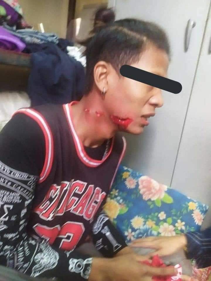 KoKyushi's tweet photo. MilitaryTerroristsJuntas are raiding  in Bagan and shooting with real bullets.Bagan is highly regarded as a holy place of Myanmar as well as a UNESCO World Heritage Site.This is breaching the rules of the world crime as BAGAN is regarded as UNESCO city.

#WhatsHappeningInMyanmar https://t.co/Rk8WVJKuYg
