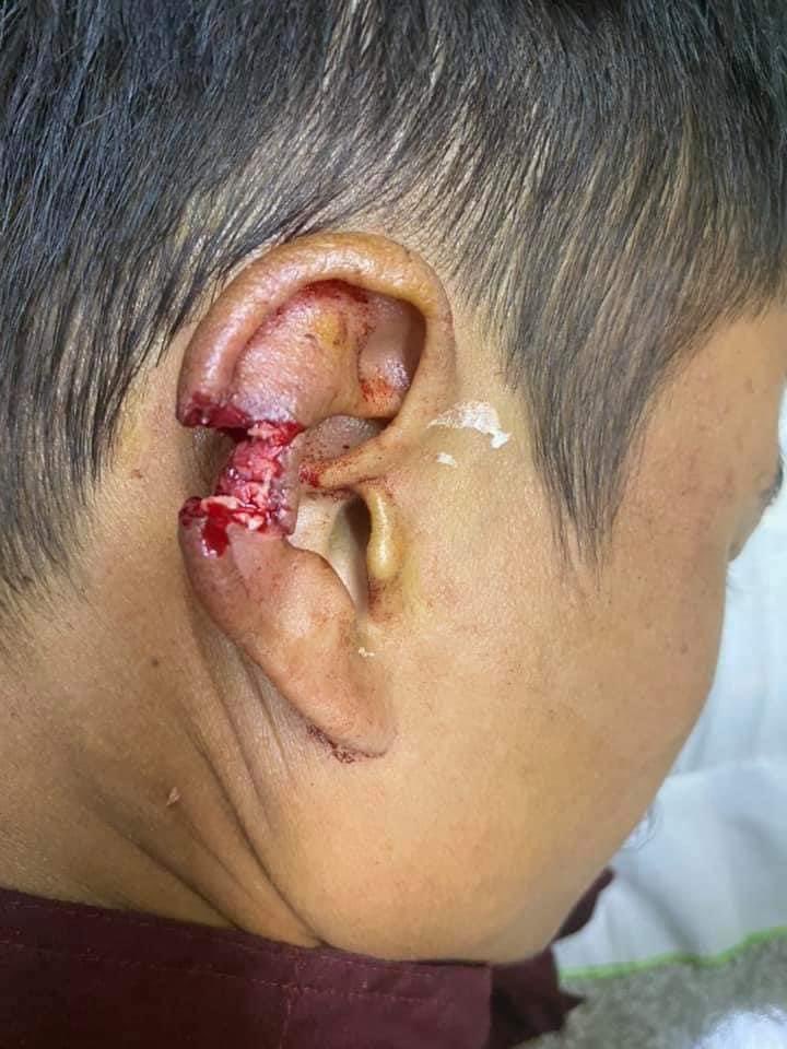 WaiYan68582144's tweet photo. Myanmar Military brutally shot to unarmed protesters in South Oakalarpa, Myanmar.
CRIME AGAINST HUMANITY 
@UN @UNHumanRights 
#CrimeAgainstHumanity  
#WhatsHappeningInMyanmar #MilkTeaAlliance 
#Mar7Coup 
TW:Blood, Wound https://t.co/oqf8xfyz0T