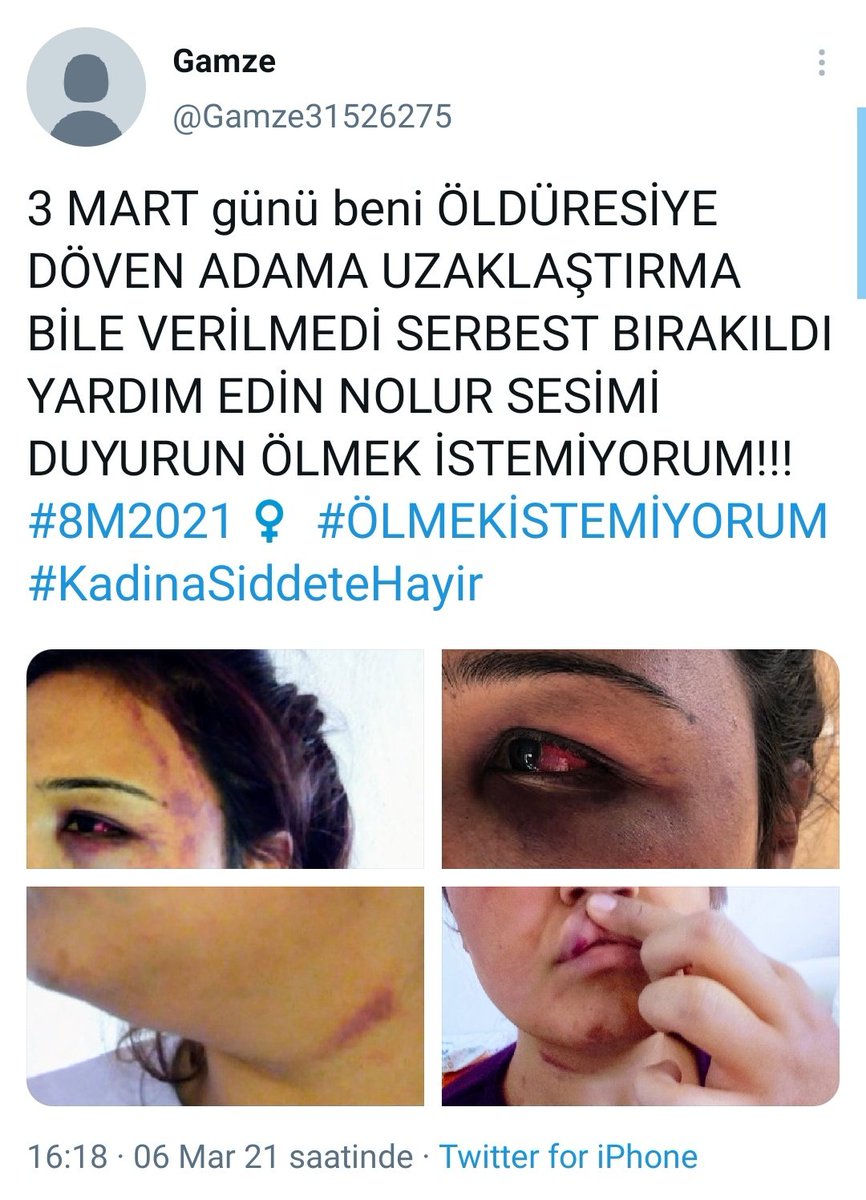 beyzoslandin's tweet photo. bir kadının daha hayatı söz konusu rtleyip yayın kurtarabiliriz 
#GamzeyeYardımEdin
#KadinaSiddeteHayir https://t.co/qexPbfuQYt