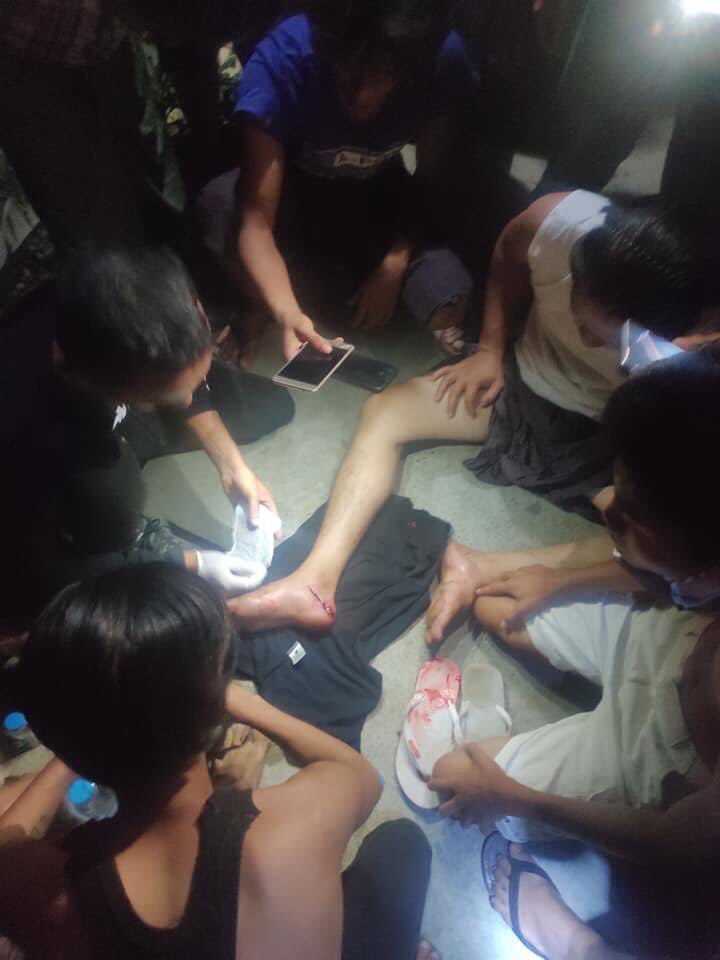 TW // Blood, Wounds

JUST IN: One person was shot at foot by terrorists in front of Wai Bar Gi Infectious Diseases Hospital.

#WhatsHappeningInMyanmar 
#Mar7Coup