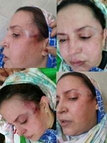 conasadh's tweet photo. #StandUp4HumanRights
#internationalwomensday2021: The systematic #Violence and #torture perpetrated by the Moroccan state of occupation against Sahrawi women is a stain on the face of the international community and its human rights mechanisms. https://t.co/YaylVOR66C