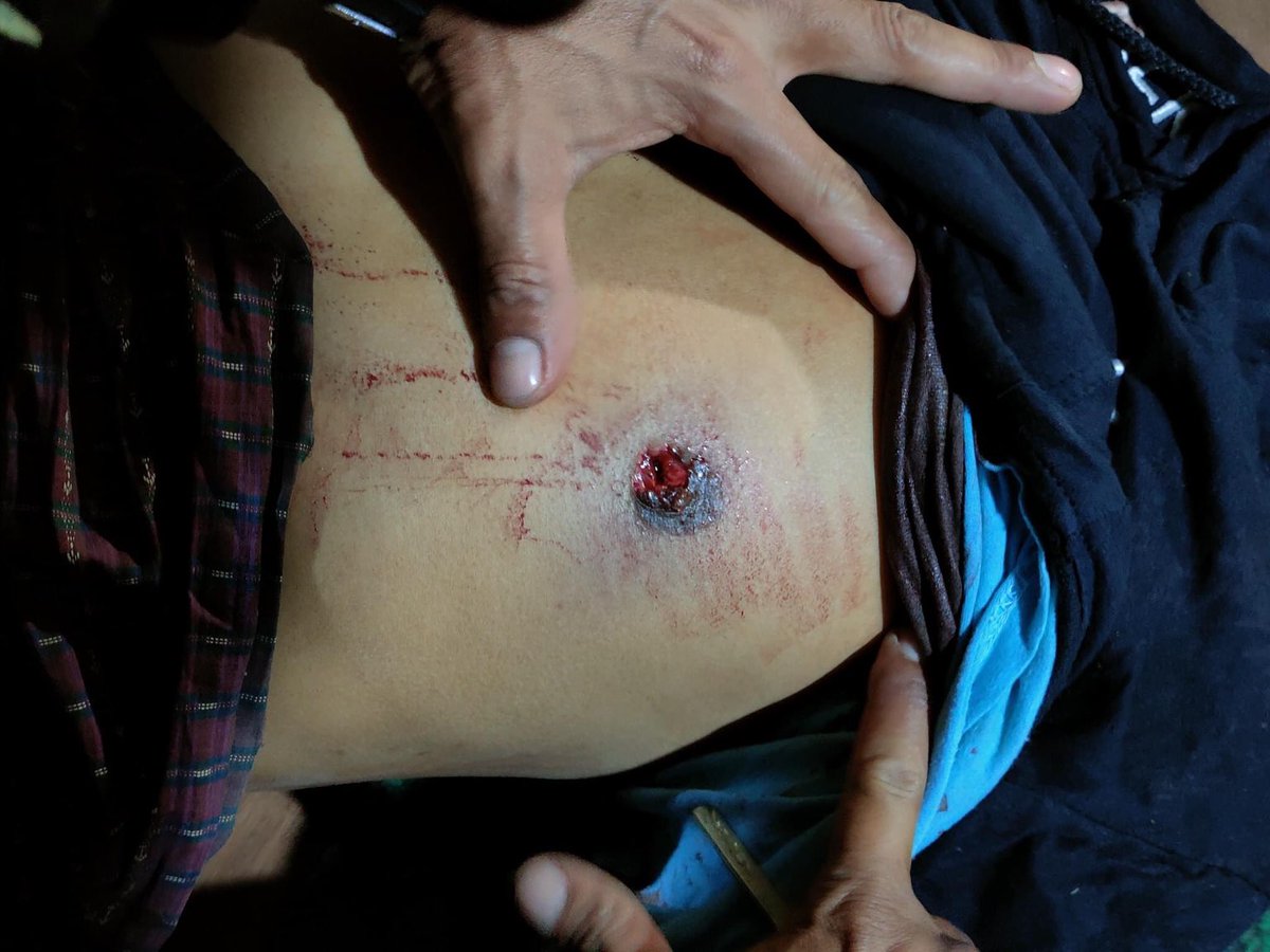 PaingPhyoeThu9's tweet photo. The Terrorist keep attacking the civilians even late at night. 
#HteeLinn 
#WhatsHappeningInMyanmar https://t.co/XIlHfffeMq