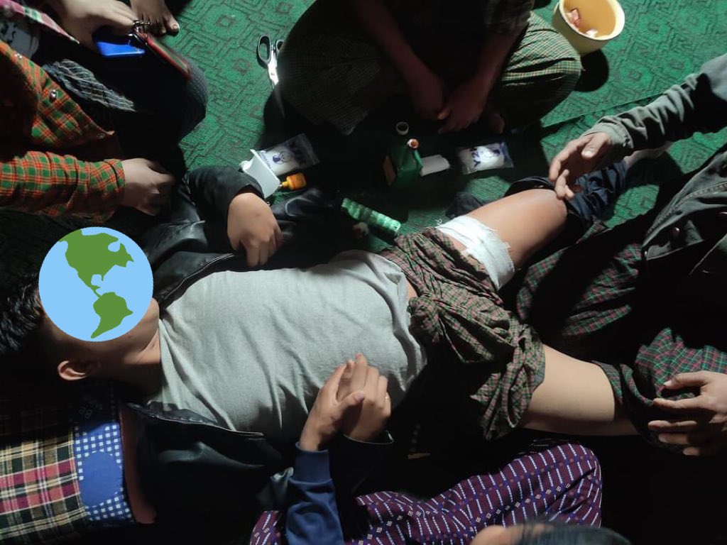 TW// death, blood , violence.

Tonight in Htee Lin city, junta’s terrorist grp came to arrest a citizen, civilians blocked but terrorists shot unarmed civilians.1 dead ,1 injured thighs ,1 injured eyes,other 7 injuries happened .

STOP SIEGE

#WhatsHappeningInMyanmar
#Mar8Coup