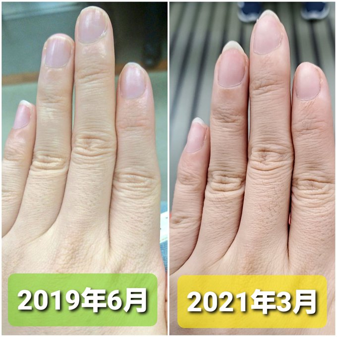 ネイルベッドのtwitterイラスト検索結果