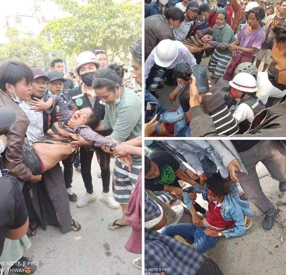 Tw// Blood; Mandalay #Mar8Coup , Military Terrorists knocked down motor vehicles and cars driving on the street with their Army Cars. 3 people were seriously injured and one hasn’t regained consciousness till now. IMPLEMENT R2P IN MYANMAR #WhatsHappeninglnMyanmar #R2PforMyanmar