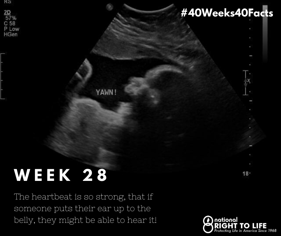 nrlc's tweet photo. Week 28: The little baby is now perfectly formed and about the size of a cantaloupe! The ears are much more developed, too; the baby can distinguish between high &amp; low pitched sounds. Their eyesight is developed enough to see the mother's face while breastfeeding! #40weeks40facts https://t.co/oQeRjRmTcp