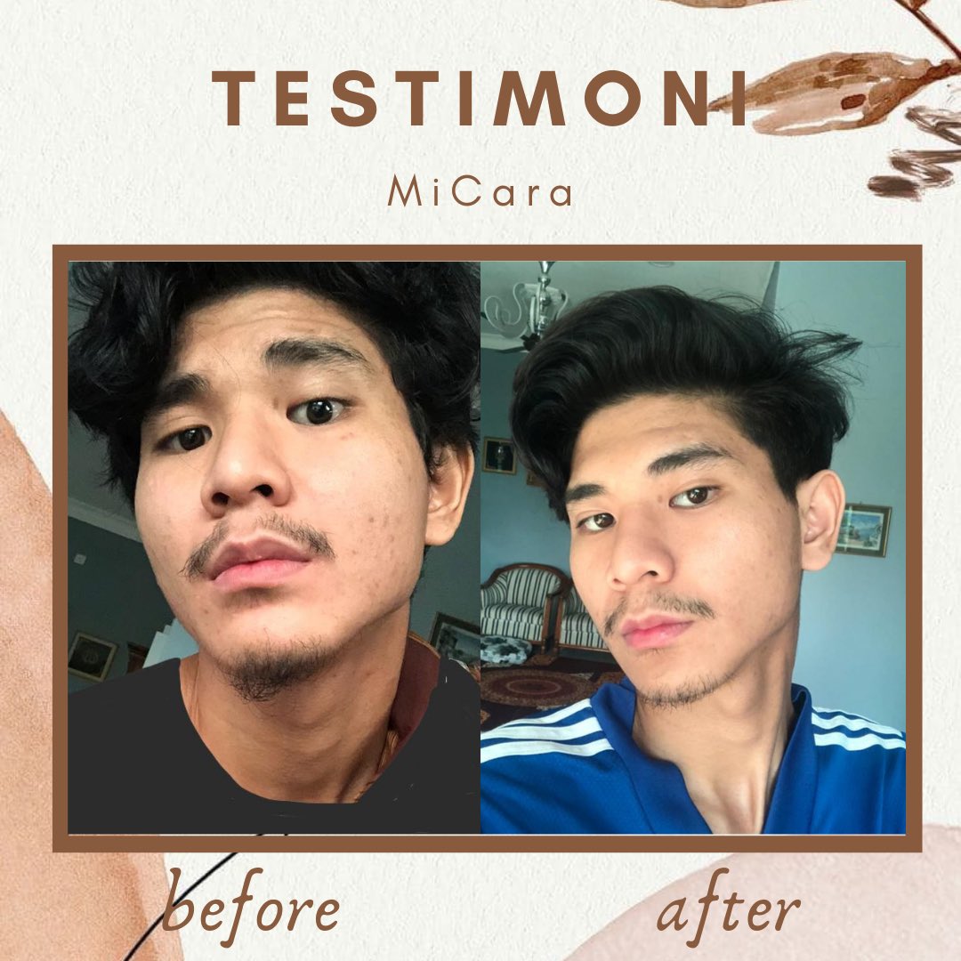 micaraherbs's tweet photo. Opssss โผ๏ธ jangan kata lelaki pun tak boleh pakai Herbs Soap Cleaser ni tau! Lelaki pun kena jaga skin muka utk nampak lagi handsome gitu! Thank you share our testimoni with us ๐ฅฐ
.
#feedbackmicara #testimonimicara #herbssoaphomemade #masalahjerawatlelaki #skinlelaki #breakoutskin https://t.co/ZhHYYBtPew