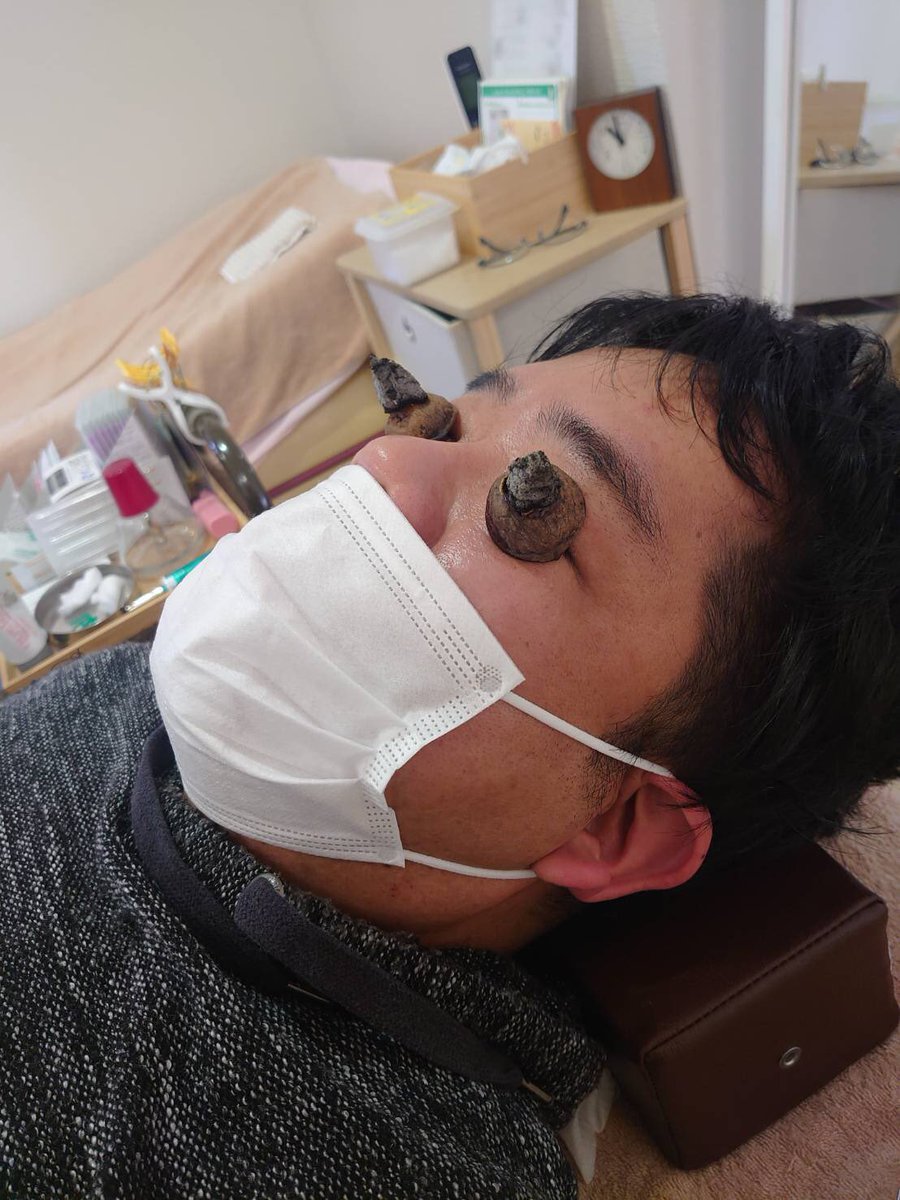 くるみ灸 くるみ灸