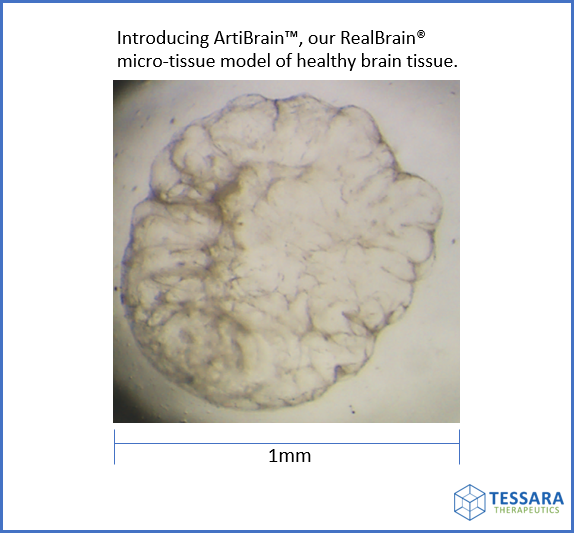 What are the best #neurology drug discovery models?

#RealBrain® micro-tissues model healthy and diseased brain tissues. Our highly reproducible #ArtiBrain™ “healthy” brain tissue model is being manufactured 4 #biopharma #drugscreening studies.
#science;#healthcare; #innovation;