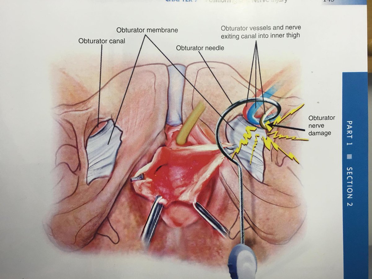 Gold Coast Pelvic Mesh Support tweet media