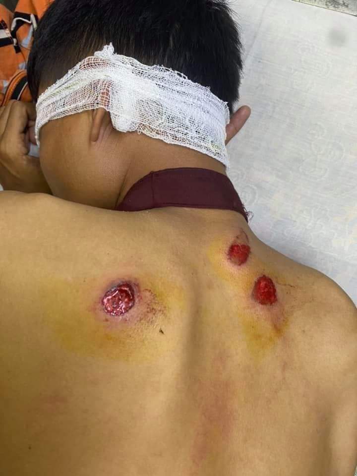 What happening in Myanmar?More than 20 youths,including women,have been arrested in connection with a March,crackdown by the military and police at South Oakkalapa Pade tha intersection in Rangoon.
#We need Democracy