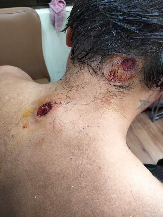 Myanmar_Now_Eng's tweet photo. Security forces tightened their presence in Yangon's Sanchaung Township- a key protest area-on Monday morning, attempting to detain anyone coming out to demonstrate. A few daring protesters were shot with rubber bullets at the corner of Kyaik Lat Street. #whatshappeninginmyanmar https://t.co/mzyZ1KmaSb