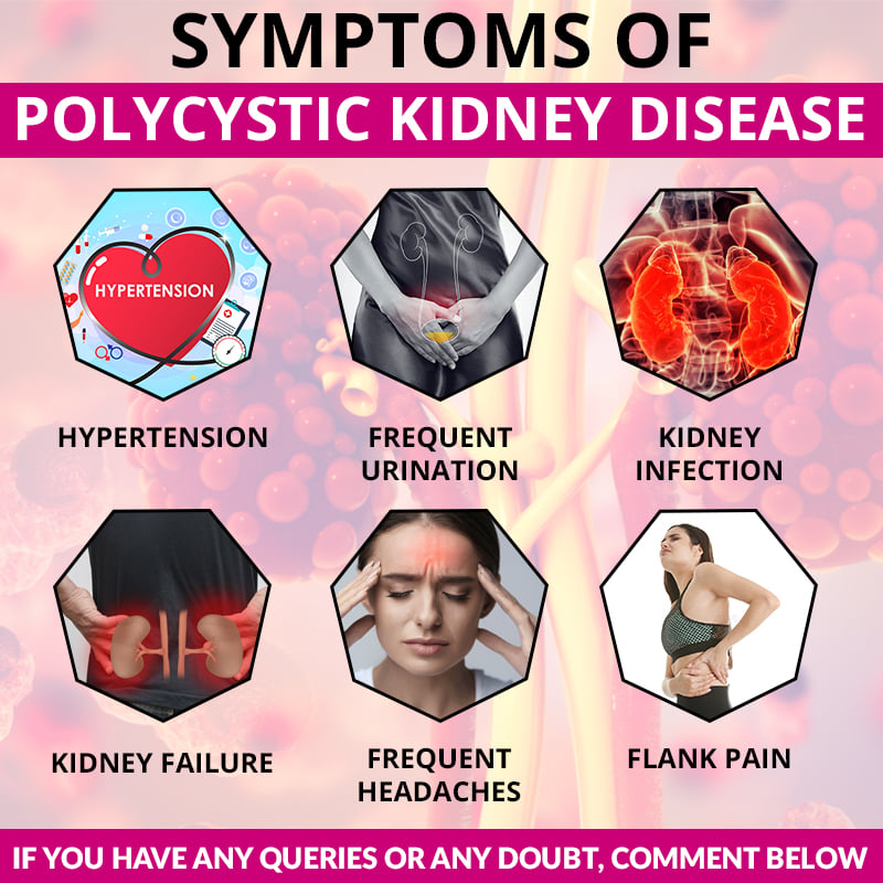 SYMPTOMS OF POLYCYSTIC KIDNEY DISEASE!!
..
..
..
..
..
#kidneydisease #PKD #polycystickidneydisease #cyst #hypertension #urination #kidneyinfection #kidneyfailure #headache #flankpain #kidneydiseaseawareness #kidney