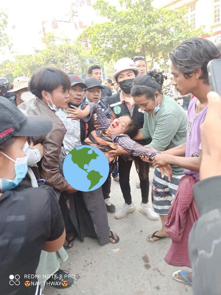 hannayuri_twt's tweet photo. tw //blood 
Two civilizations on motorcycle were extremely injured by hit and run of  terrorists in uniforms. CCTV record in previous tweet ‼️
STOP SIEGE
#WhatsHappeningInMyanmar
#Mar8coup https://t.co/SIbU9MWx0d