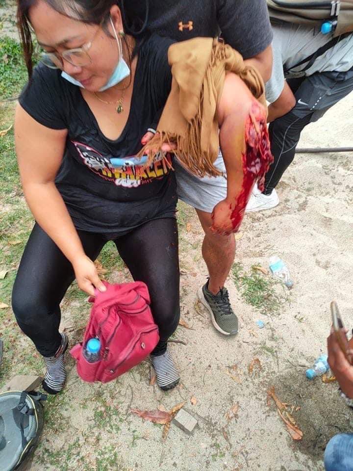 TW // Blood Graphic

Breaking News : 2 death in #Myitkyina #Myanmar 

#WhatsHappeningInMyanmar  #Mar8Coup 
<a href="/freya_cole/">Freya Cole</a> <a href="/RapporteurUn/">UN Special Rapporteur Tom Andrews</a>
