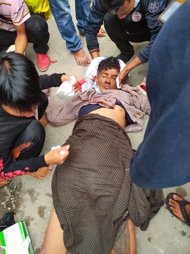 HayMarKhin5's tweet photo. Tw// Blood,Dealth,Gunshots
Red code 🚨🚨🚨
Happening now in Myitkyina, Kachin State. Two  was head shot by the Junta terrorists and one was dead on the spot. One woman shot in arm .Many People injured.This is how the terrorists dispersed the protesters.Unlawful act!#Mar8Coup https://t.co/mCdG5HppC2