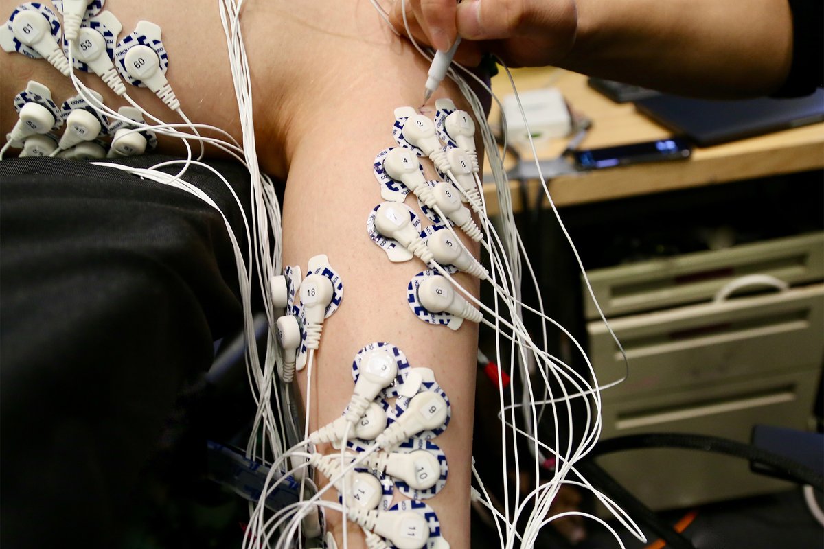 Person on a medical exam table with dozens of electrodes attached to their arm and side.