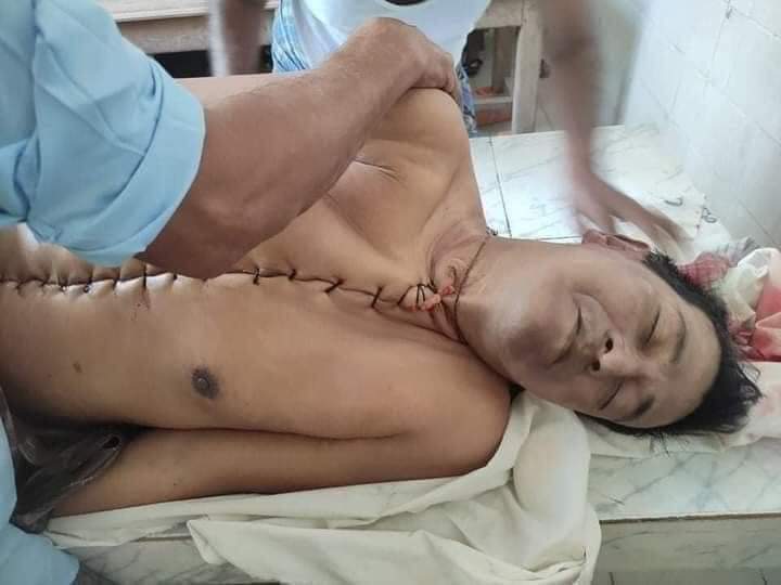 Pics of Dead body of U Khin Maung Latt (Pa bel Tan township, 7th ward ,NLD  Chairman) were taken when police informed his family to take the dead body from where he was detained. Arbitrary killings in Myanmar!

TW// Dead body

STOP SIEGE
#Mar8Coup
#WhatsHappeningInMyanmar