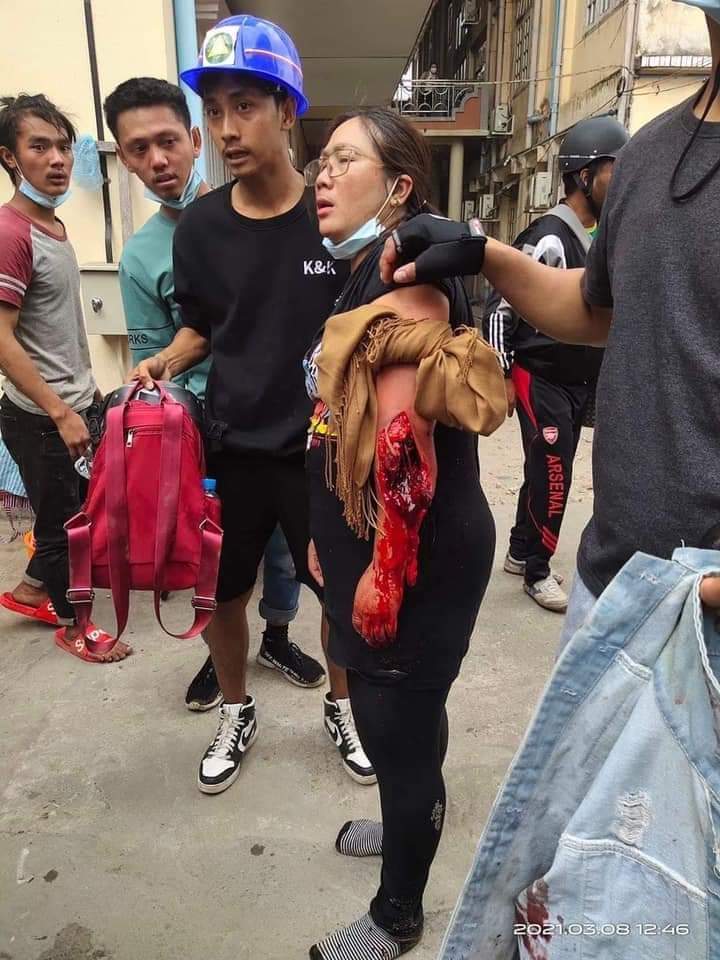 ThuHanna4's tweet photo. @freya_cole @cvdom2021 tw//blood

Military shot peaceful protesters in Myitkyina and one person dead !😭

#WhatsHappeningInMaynmar 
#Mar8Coup https://t.co/4MBXNPXGGW https://t.co/63Z8Pxi3GO