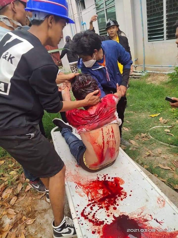ThuHanna4's tweet photo. @freya_cole @cvdom2021 tw//blood

Military shot peaceful protesters in Myitkyina and one person dead !😭

#WhatsHappeningInMaynmar 
#Mar8Coup https://t.co/4MBXNPXGGW https://t.co/63Z8Pxi3GO