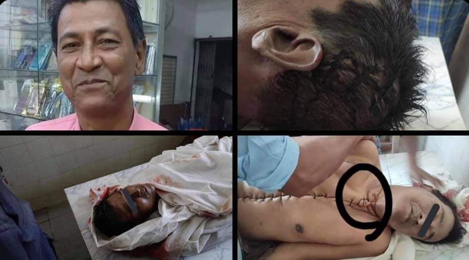 TW // dead body
U Khin Maung Latt ,NLD’s  7 ward chairman from Pabedan.He was arrested and killed brutally by military juntas .Family  collect his body at hospital.The body was dissected and sewn in chest and head sewn 
<a href="/POTUS/">President Donald J. Trump</a> <a href="/BBCWorld/">BBC News (World)</a> 
#WhatsHappeningInMyanmar  #Mar8Coup