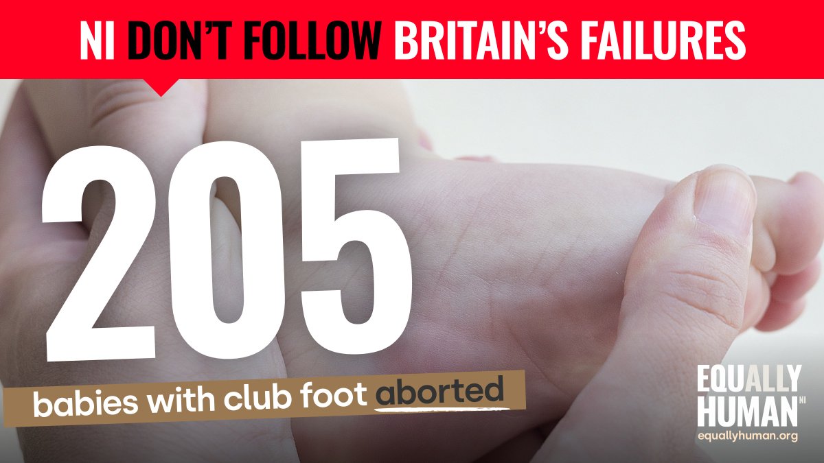 RightToLifeUK's tweet photo. While the Department of Health and Social Care is reluctant to release data on abortions where a baby has club foot, data reported by Eurocat showed that 205 babies with club foot were aborted in England and Wales between 2006 and 2010. https://t.co/0MnyCkAWJd 
#EquallyHuman https://t.co/yq7WZk5HJo