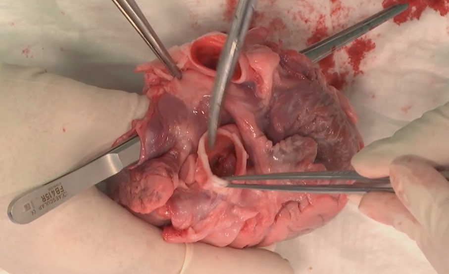 European Vascular Course tweet media