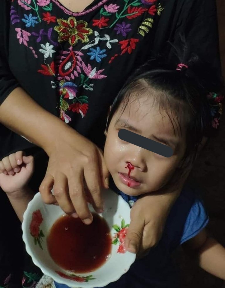 Elina16151321's tweet photo. Happening now(around 10pm) :In Baho road of Sanchaung township
Min Aung Hlaing's terroists are raiding using violent forces.
A resident said "his daughter is suffering from tear gas and  she can't breath well". 
@freya_cole @UN_HRC
#WhatsHappeningInMyanmar
#Mar8Coup https://t.co/mE6YUB2miV