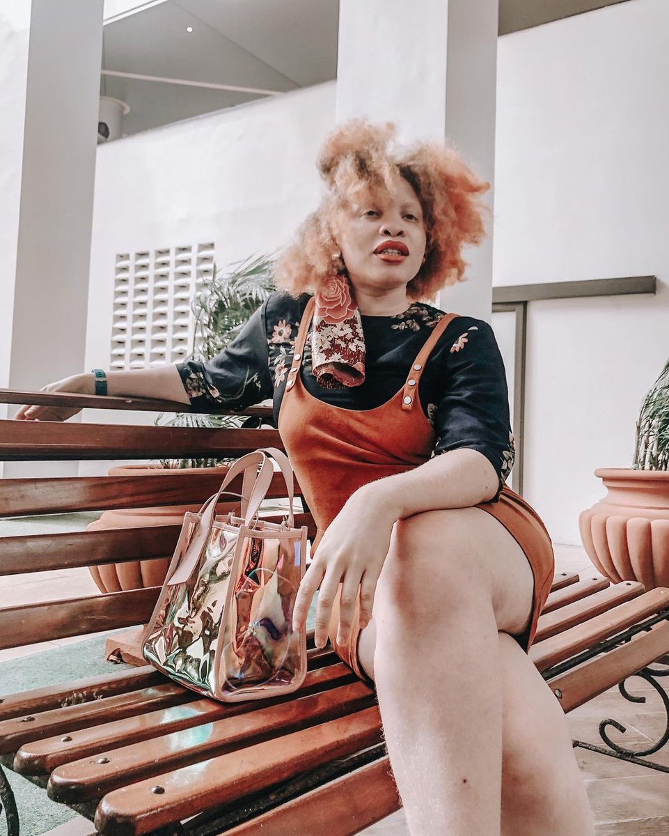 OAMFoundation's tweet photo. Crushing on @heycocopops
#OAMFoundation #InternationalWomensDay #IWD2021 #ChooseToChallenge #MondayMotivation #InMySkinIWin #BeyondTheComplexion #Albinism #AlbinismAwareness https://t.co/AfvzlPl72p